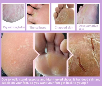 Masque Peeling Pieds Exfoliant